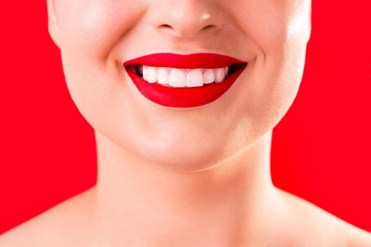 What Are The Key Features Of A Hollywood Smile Procedures